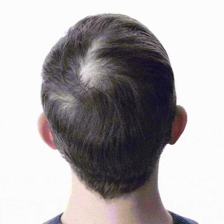 Follicura Hair Growth Activation Serum