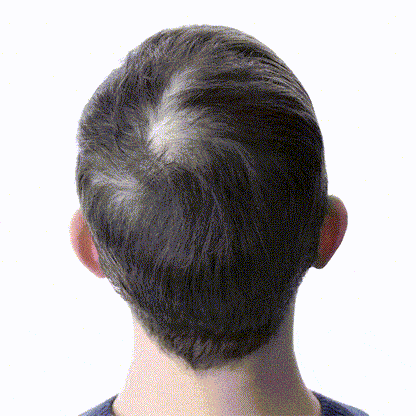 Follicura Hair Growth Activation Serum