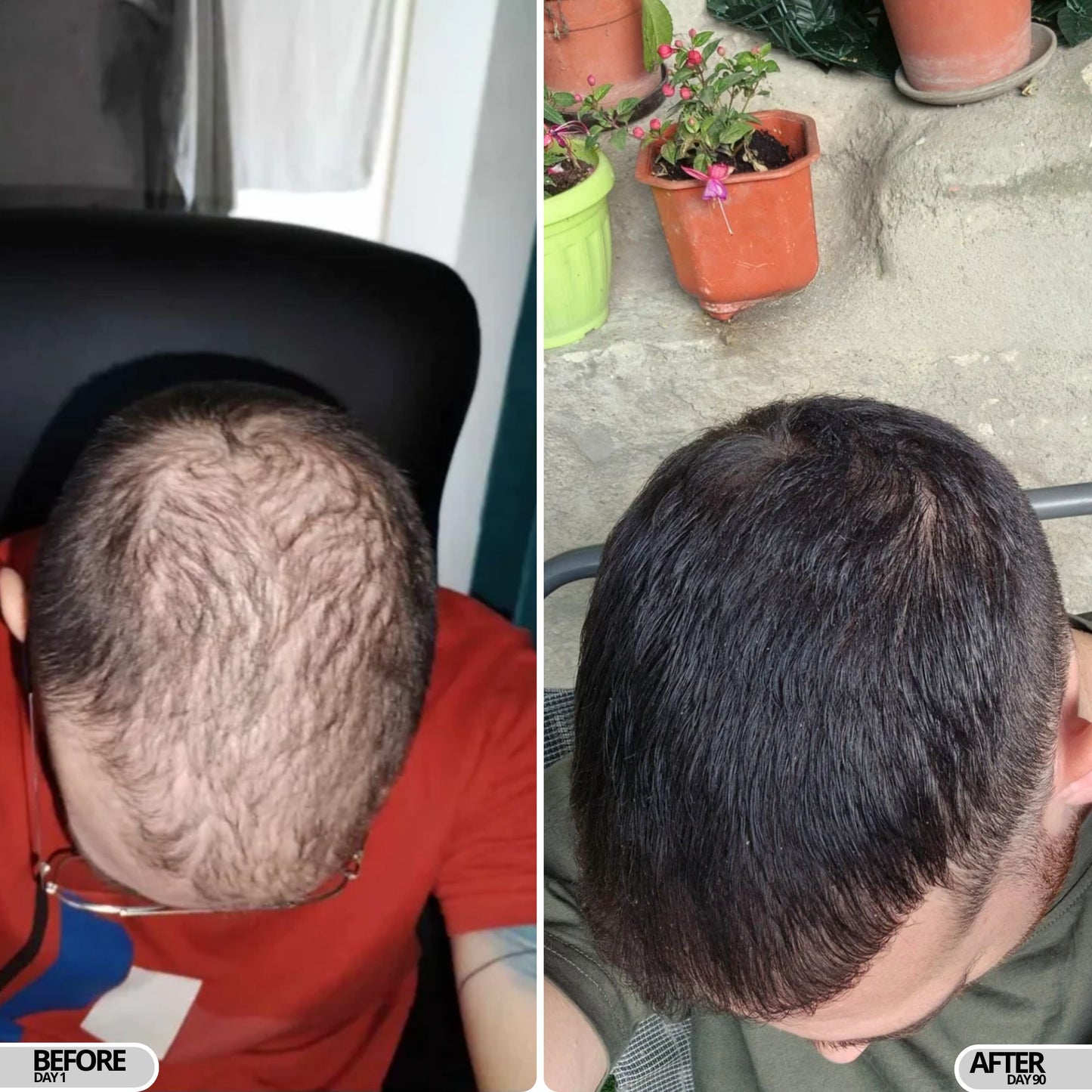 Follicura Hair Growth Activation Serum