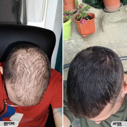 Follicura Hair Growth Activation Serum